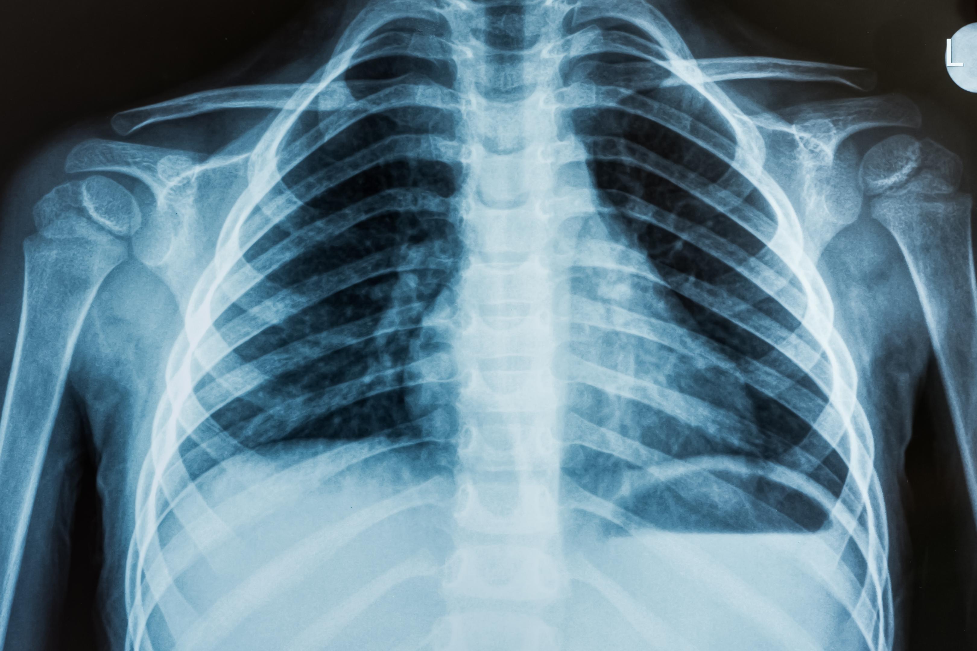 Integración de la Inteligencia Artificial en Radiología